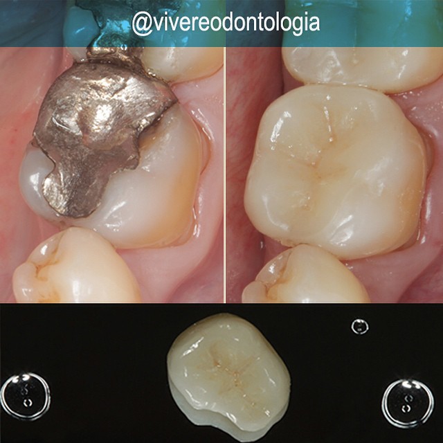 Reconstrução Estética — antes e depois